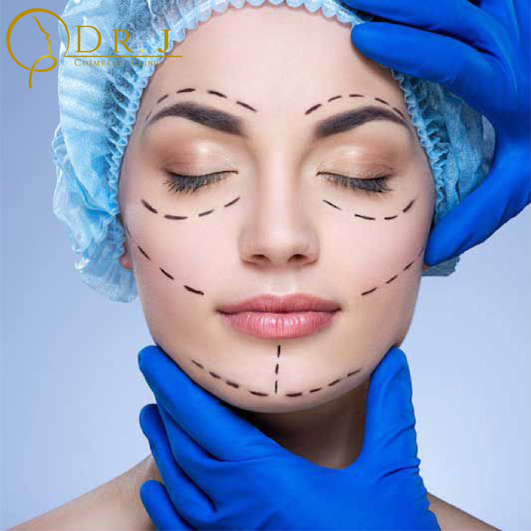 Пластична хірургія